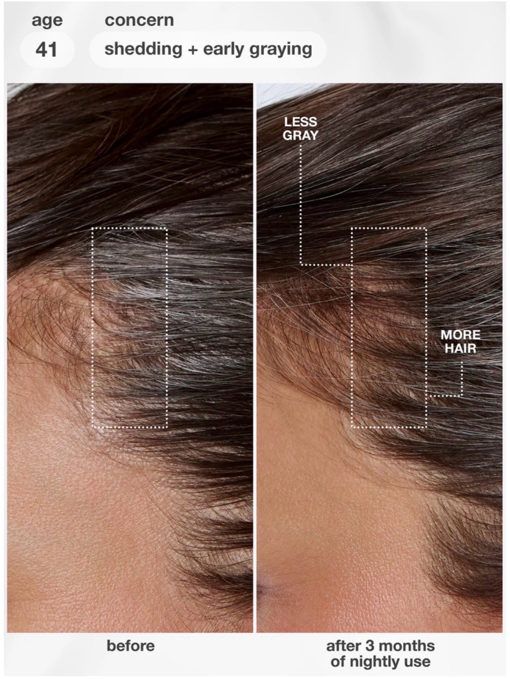 K18 FutureIQ Biomimetic Hair Serum - Picture 3 of 8